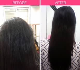 hair fall treatment