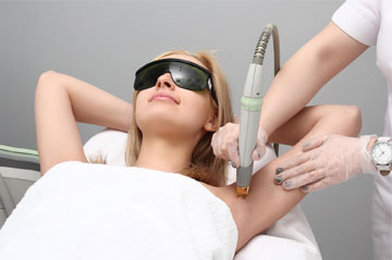 Laser Hair Removal