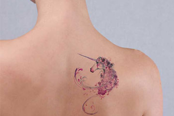 Laser Tatoo Removal