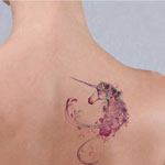 Laser Tatoo Removal